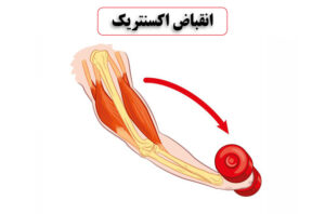 انقباض اکسنتریک